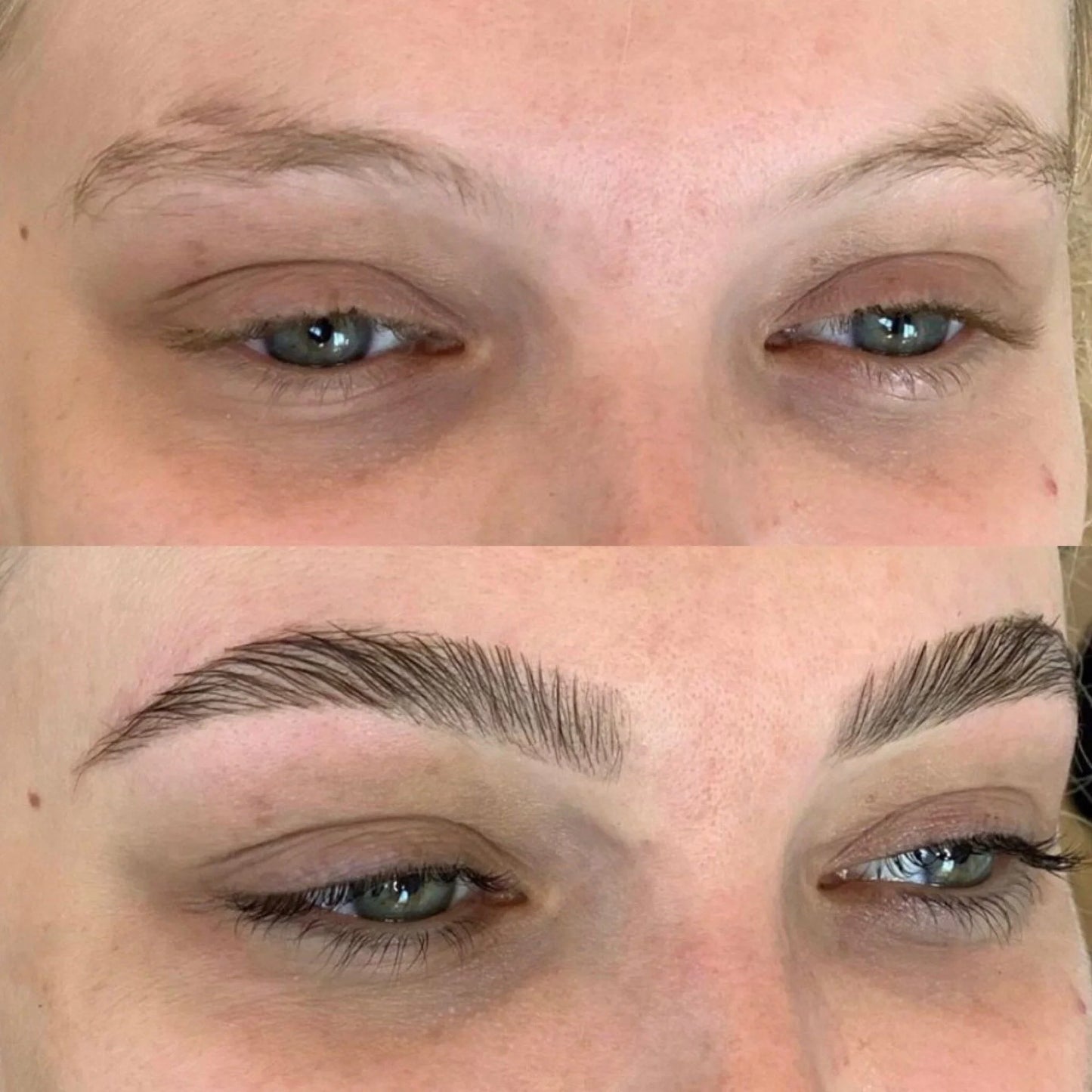 Hair Growth & Beard Needling Roller - 2-Piece Derma Roller