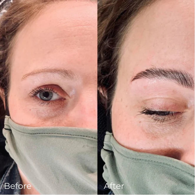 Hair Growth & Beard Needling Roller - 2-Piece Derma Roller